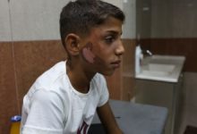 صورة تعذيب طفل في حماة يثير غضباً واسعاً.. السلطات تتحرك وتوقف المتورط
