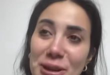 صورة كريستين شاهين تجمع تبرعات باسم السويداء لتجري بها عمليات تجميل