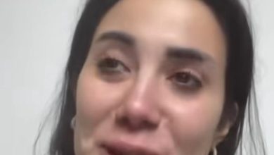 صورة كريستين شاهين تجمع تبرعات باسم السويداء لتجري بها عمليات تجميل